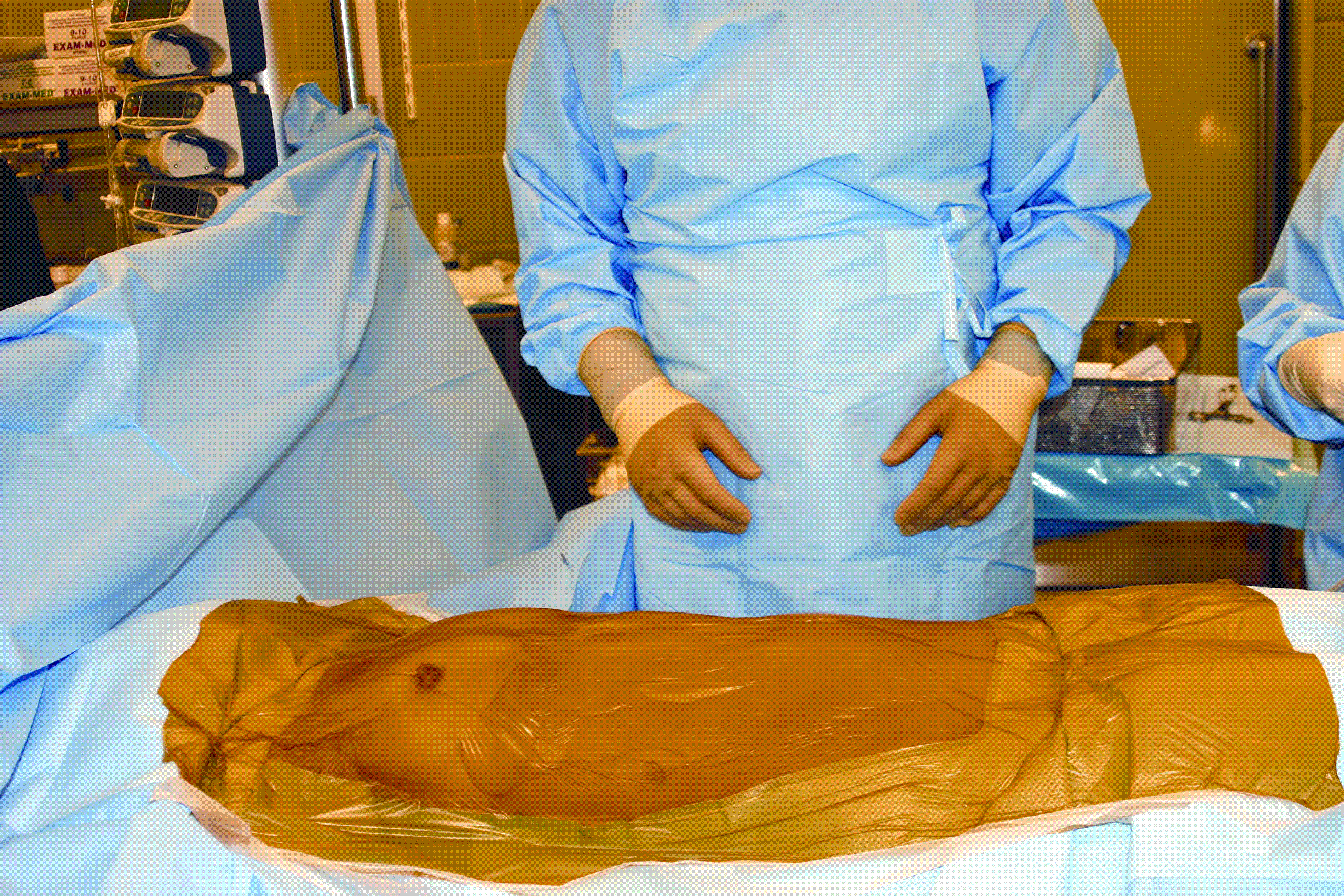 Preoperative Arrangements For Organ Donation Springerlink
