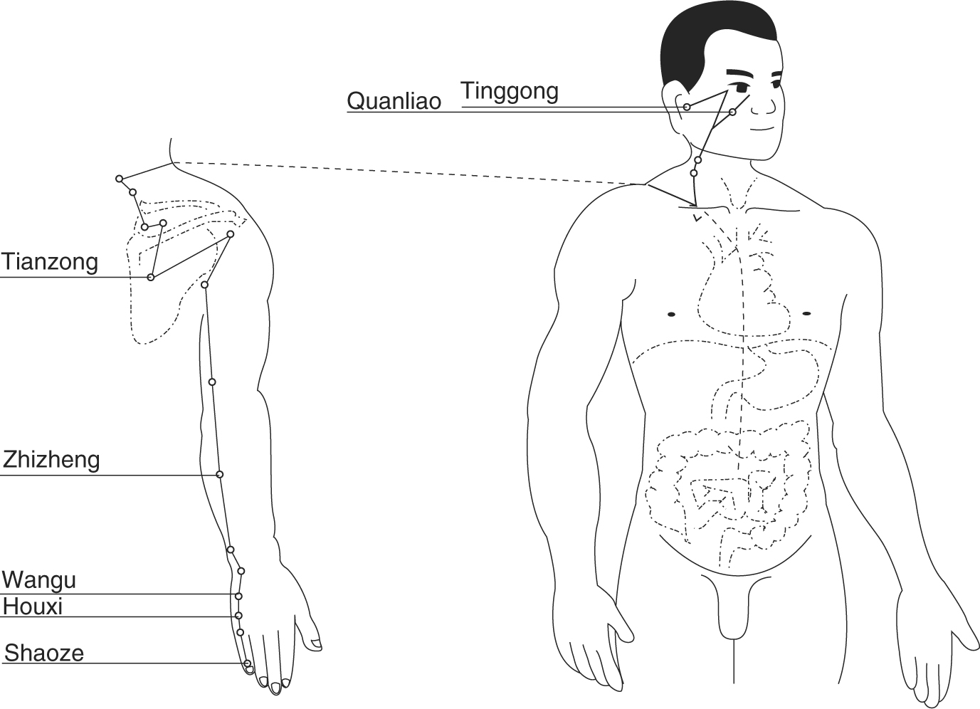Resultado de imagen para Shensu (BL23), Dachangshu (BL25), Ciliao(BL32), Weizhong (BL40), Kunlum (BL60),  Huantiao (GB30),y Yanglingquan (GB34)