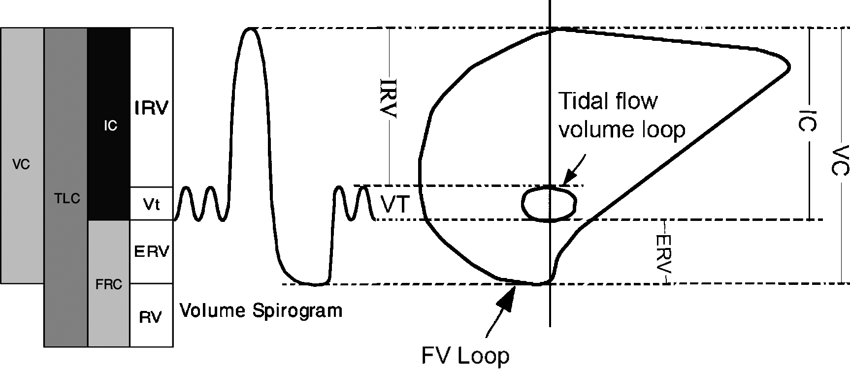 Spirometry | SpringerLink