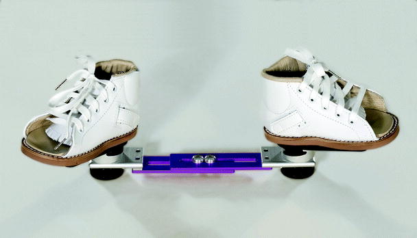 The Clubfoot Congenital Talipes Equinovarus Springerlink