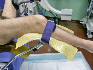 Ecirs Patient Positioning And Organization Of The Operating