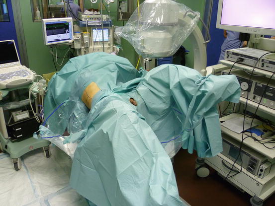 Ecirs Patient Positioning And Organization Of The Operating