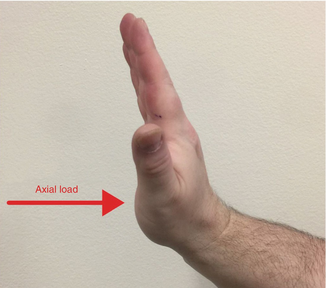 Distal Radius Springerlink