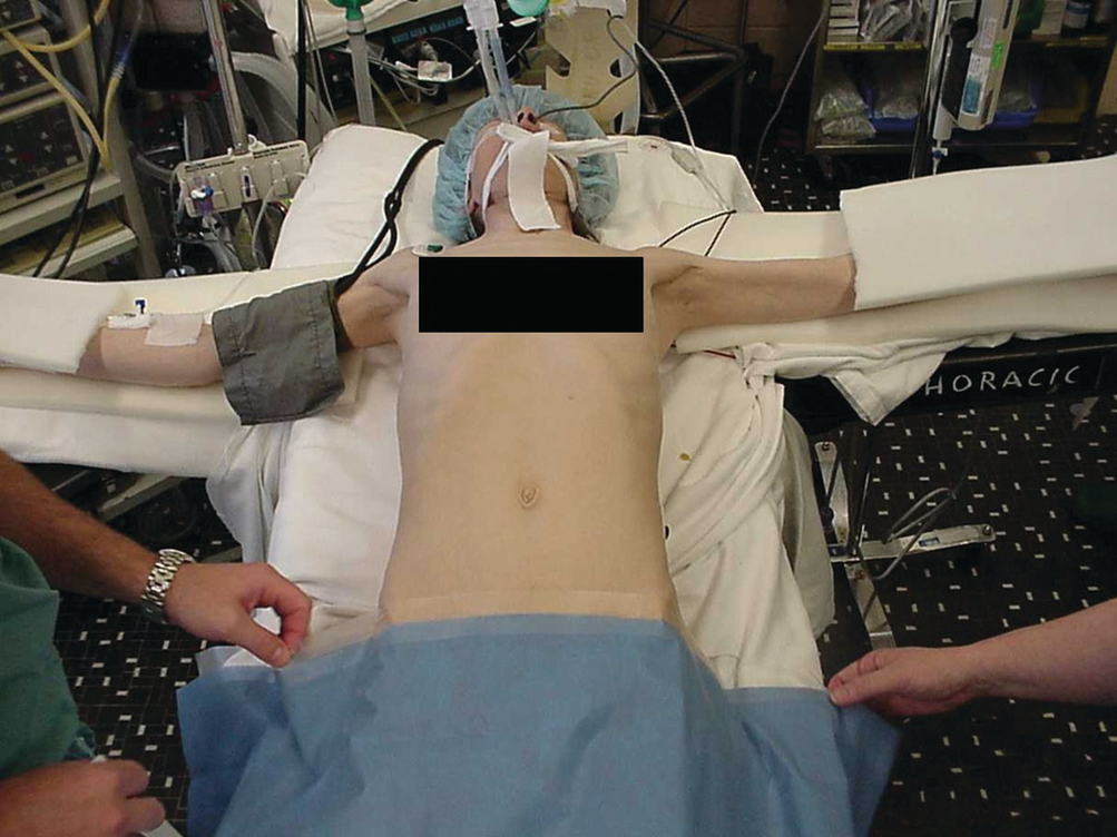 Intraoperative Patient Positioning And Neurological Injuries Springerlink