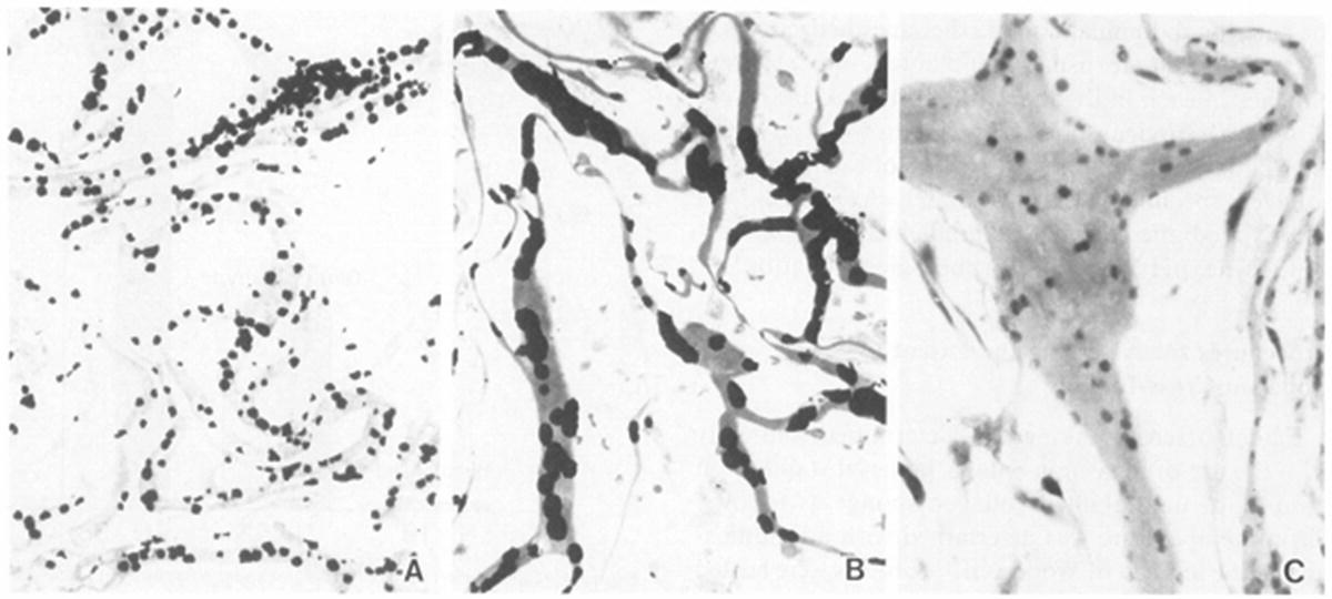 Bioprosthetic Heart Valves From A Biomaterials Perspective