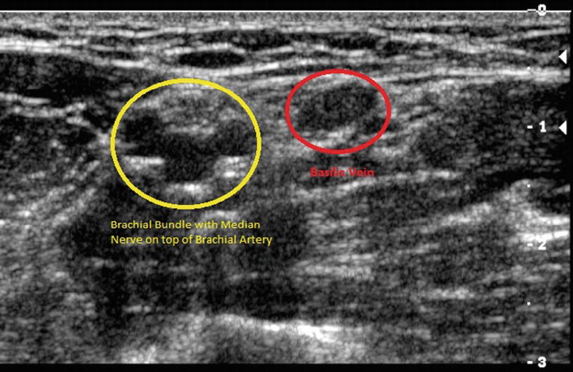 Right Assessment And Vein Selection Springerlink Right Assessment And Vein Selection Springerlink