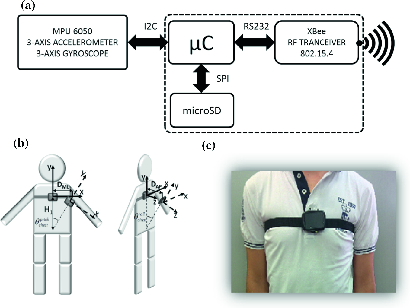 A Wearable Device To Support The Pull Test In Parkinson Disease Springerlink