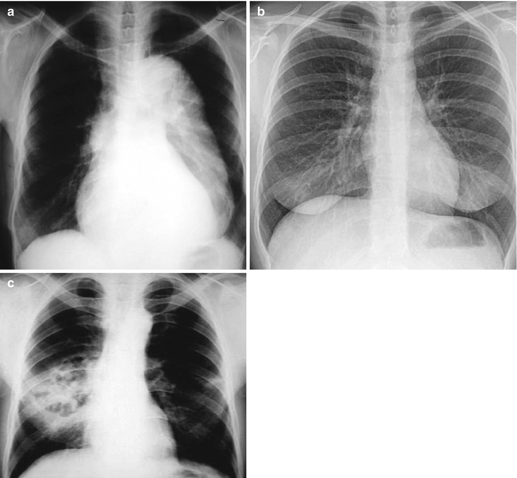 Acute Medical Events Falls Seizures Cvas Urinary Retention Cardiac Events Hypotension Siadh Dehydration And Infection Springerlink Acute Medical Events Falls Seizures Cvas Urinary Retention Cardiac Events Hypotension Siadh Dehydration And Infection Springerlink