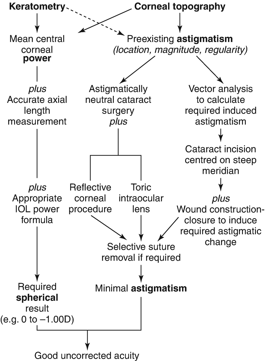 Cataract Surgery Springerlink