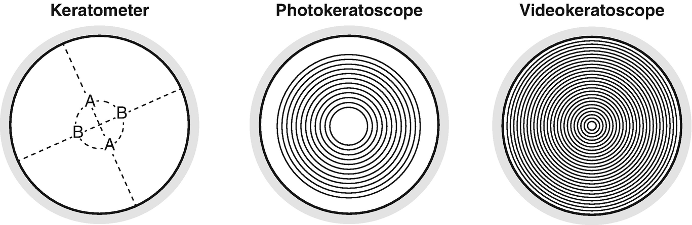 Videokeratoscopes | SpringerLink