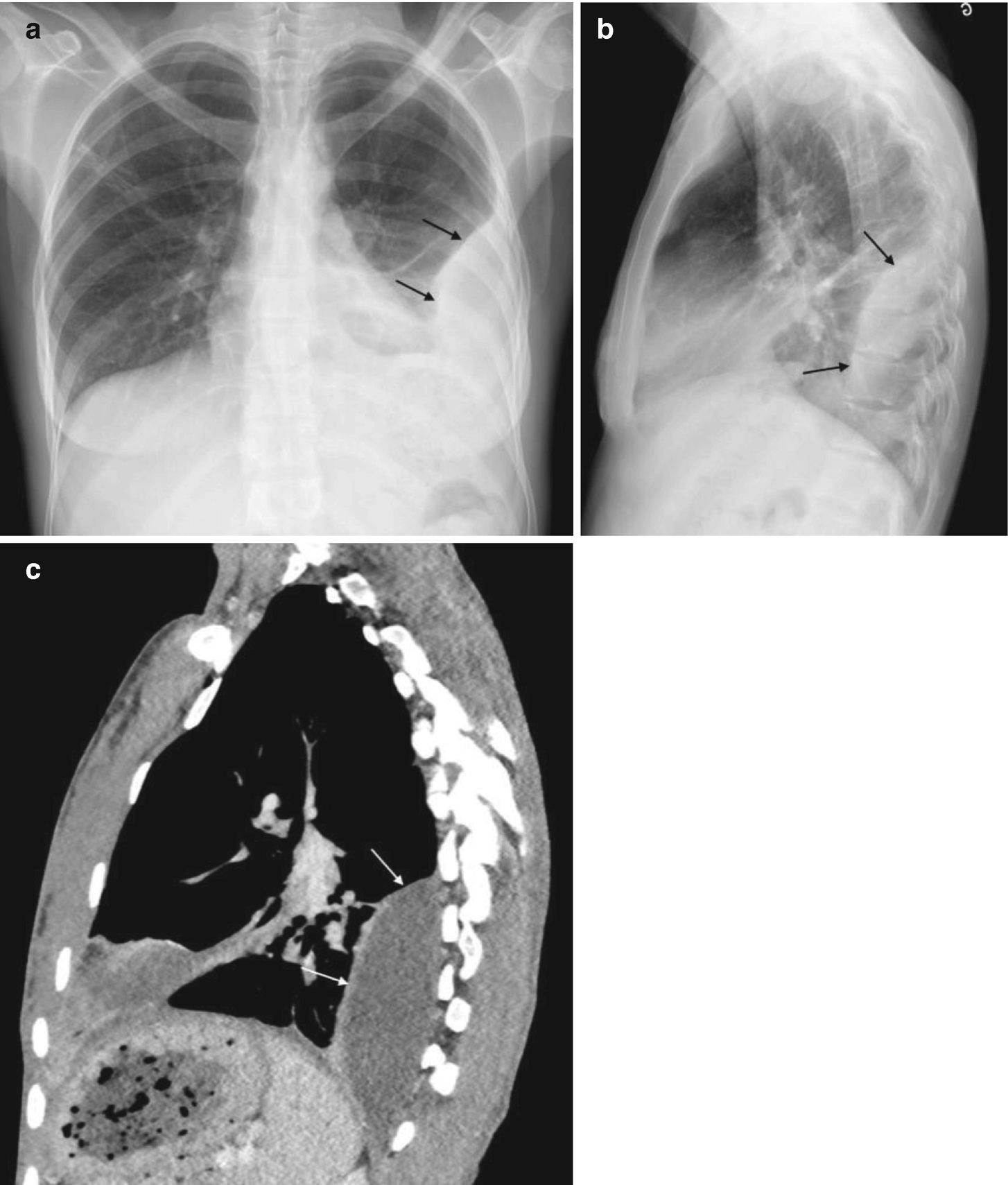 A Systematic Approach To Chest Radiographic Analysis Springerlink