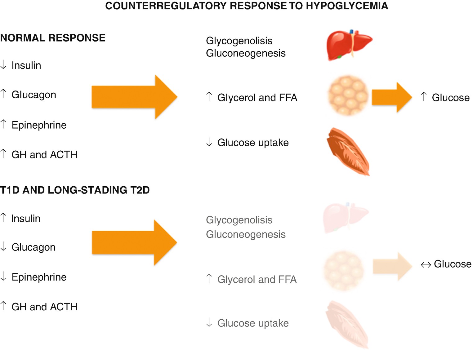 Hypoglycemia Diagnosis Management And Prevention Springerlink