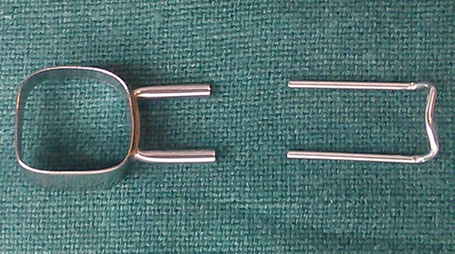 Space Maintenance In The Primary Dentition Custom Made And Prefabricated Springerlink