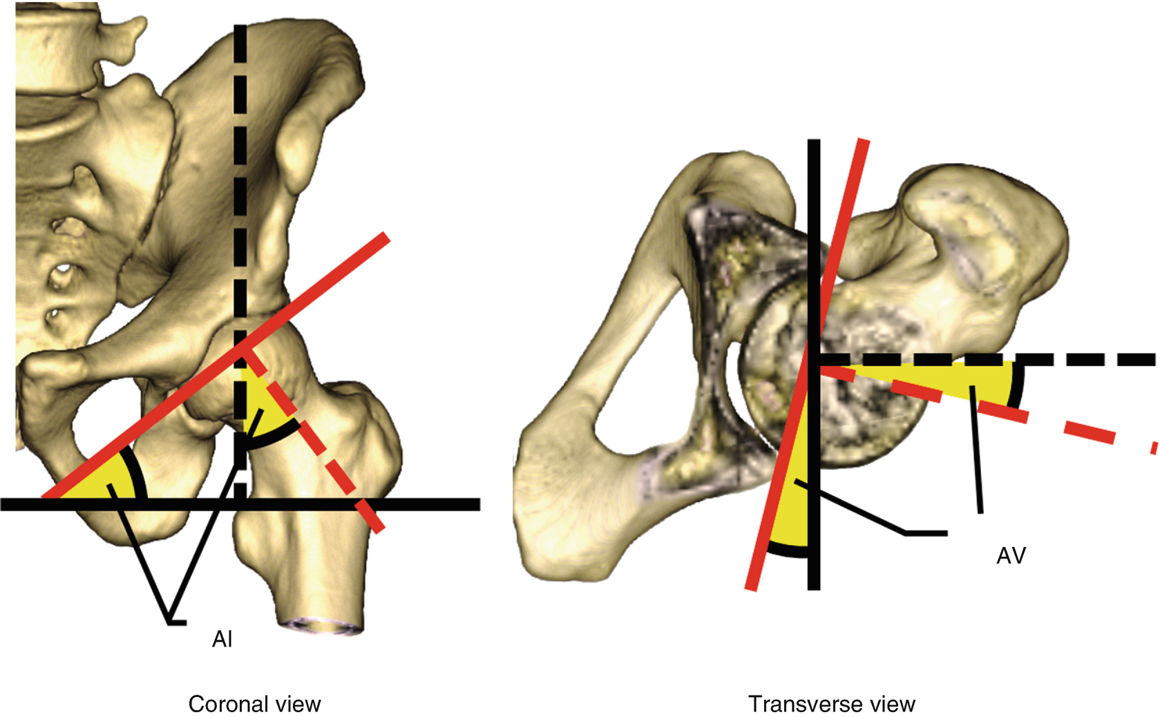 Biomechanics of the Hip During Gait | SpringerLink