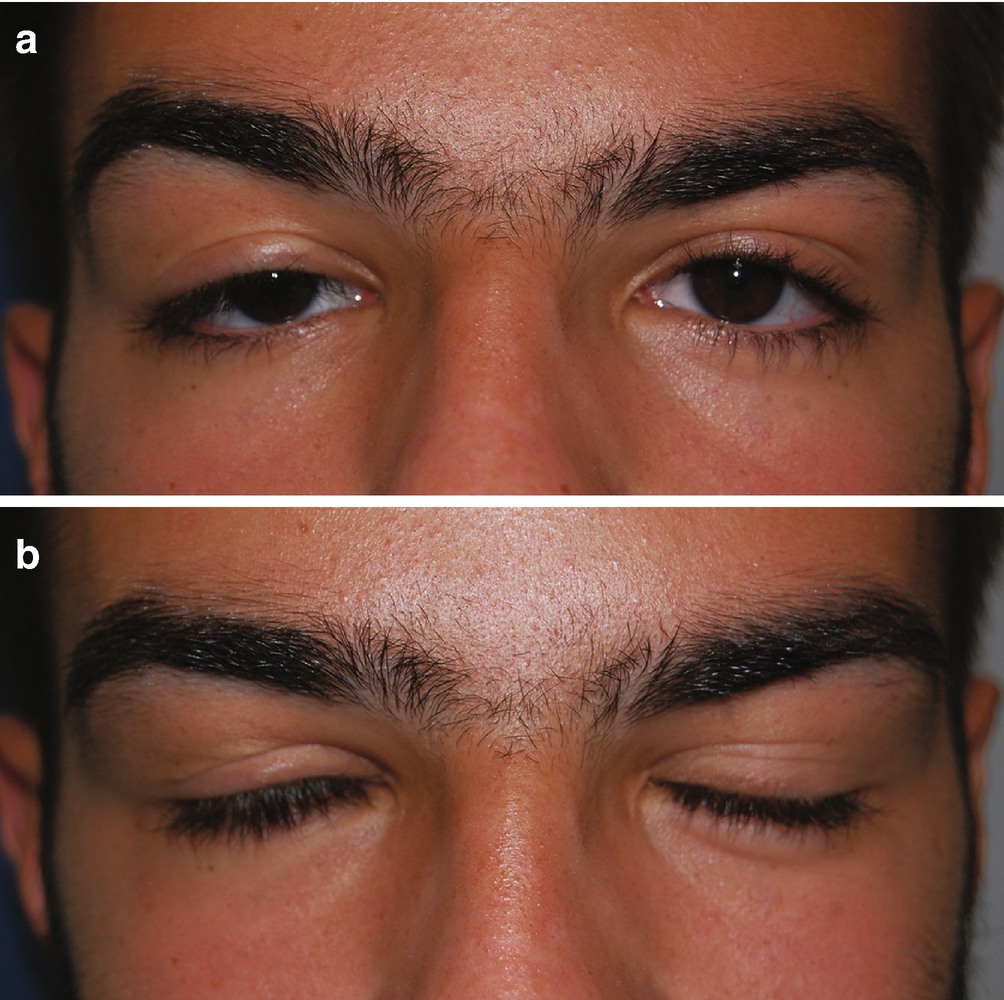 Evaluation Of The Oculofacial Patient Springerlink