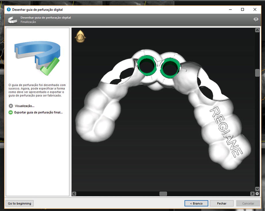 Materialise Simplant Pro V11.04 Free Materialise Simplant Pro V11.04 Free