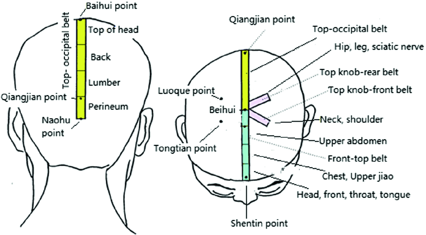 Acupuncture Styles In Current Practice Springerlink