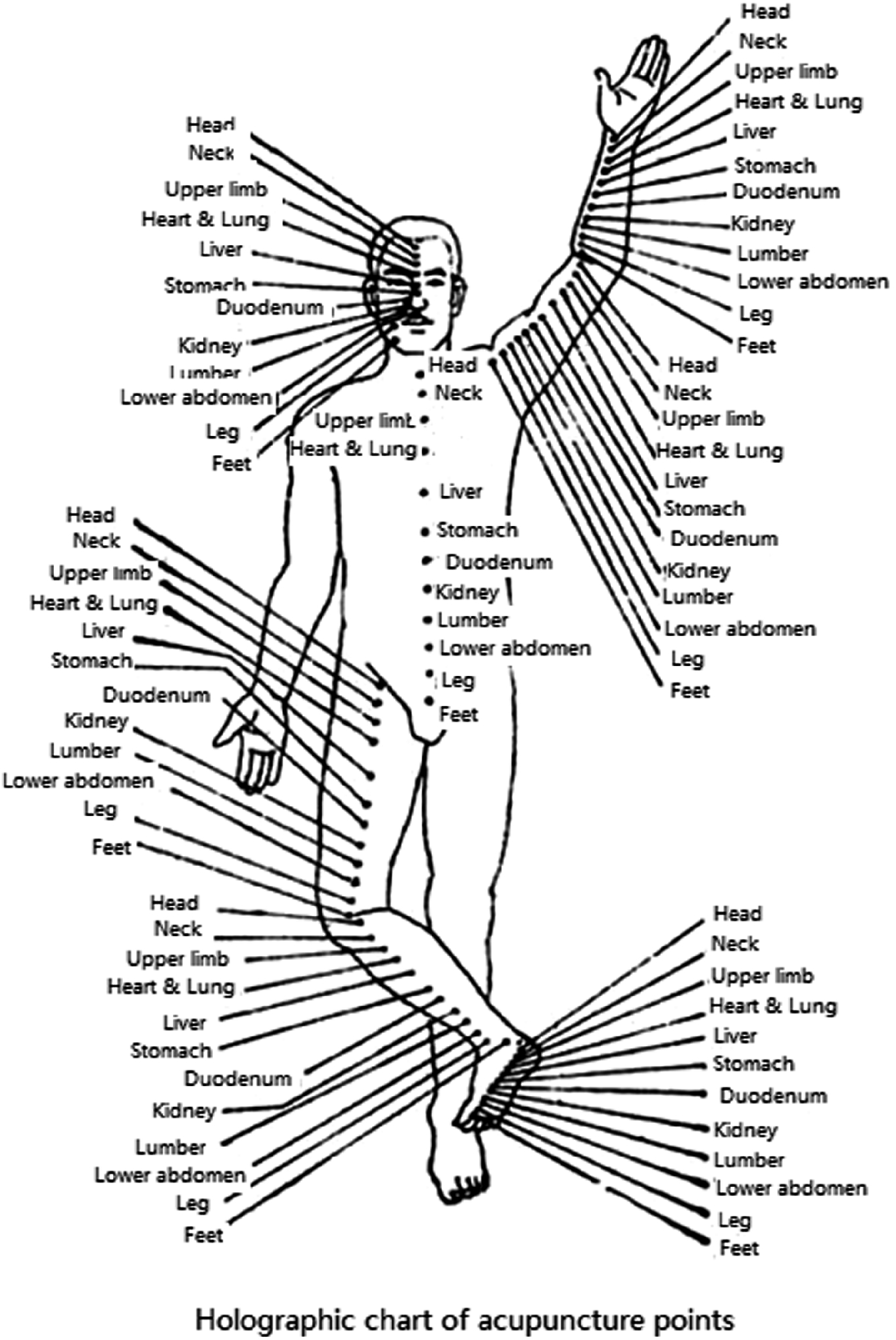 Acupuncture Needle Placement Chart