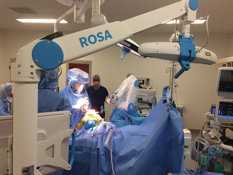 zimmer robotic knee surgery
