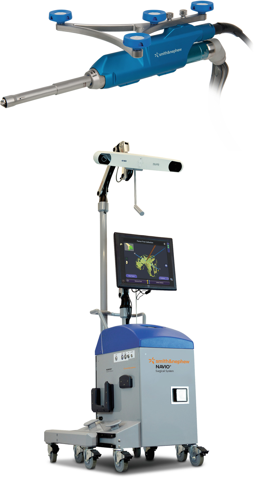 navio surgical system cost