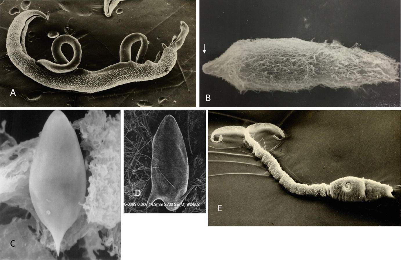 schistosomiasis worm size)