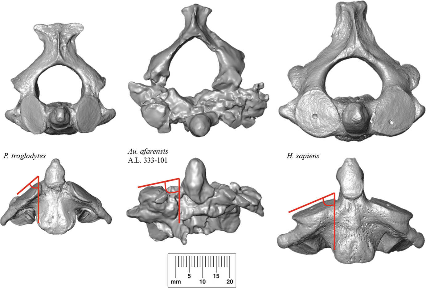 The Spine of Australopithecus | SpringerLink