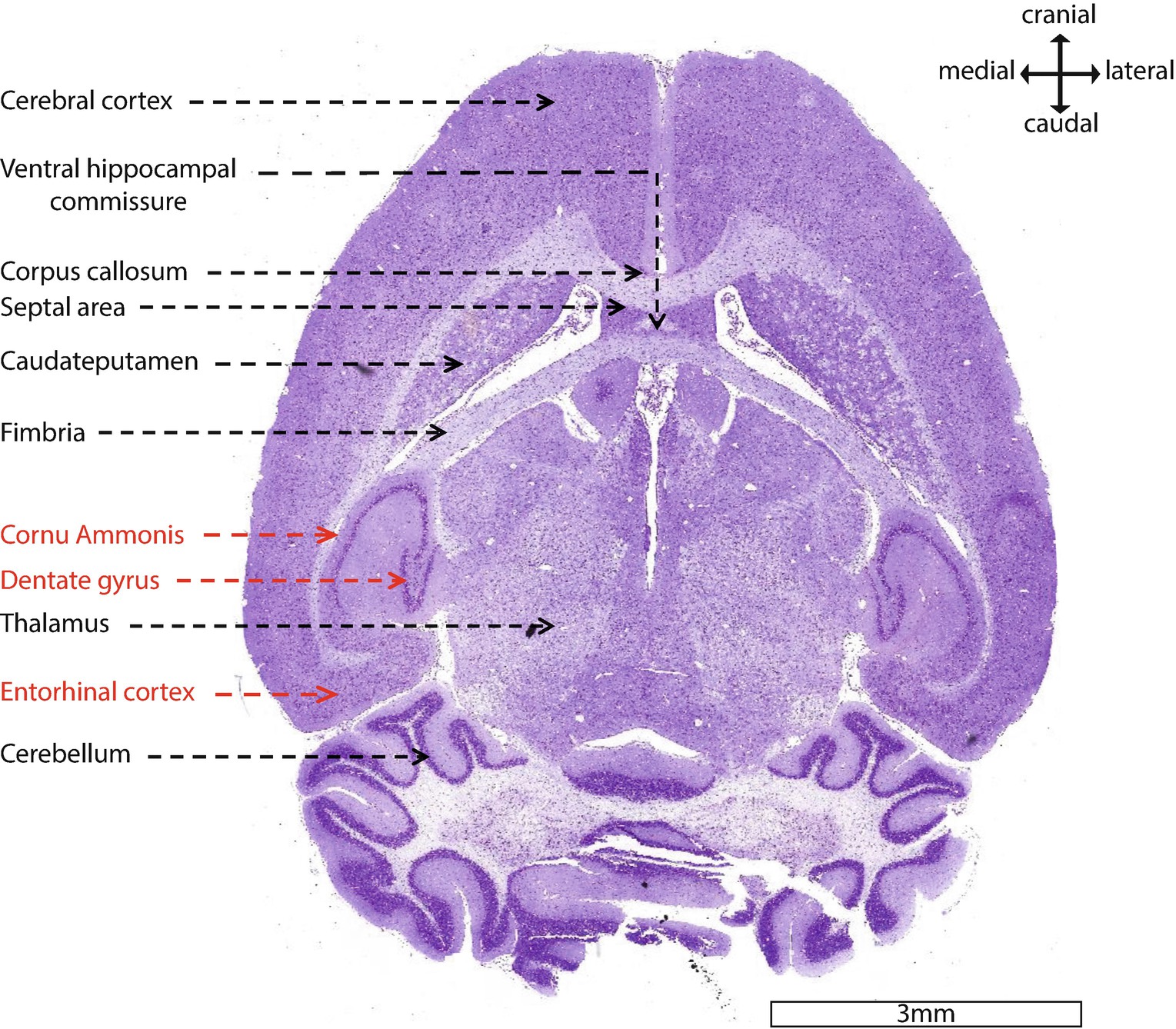 mouse hippocampus anatomy labels mouse hippocampus anatomy labels