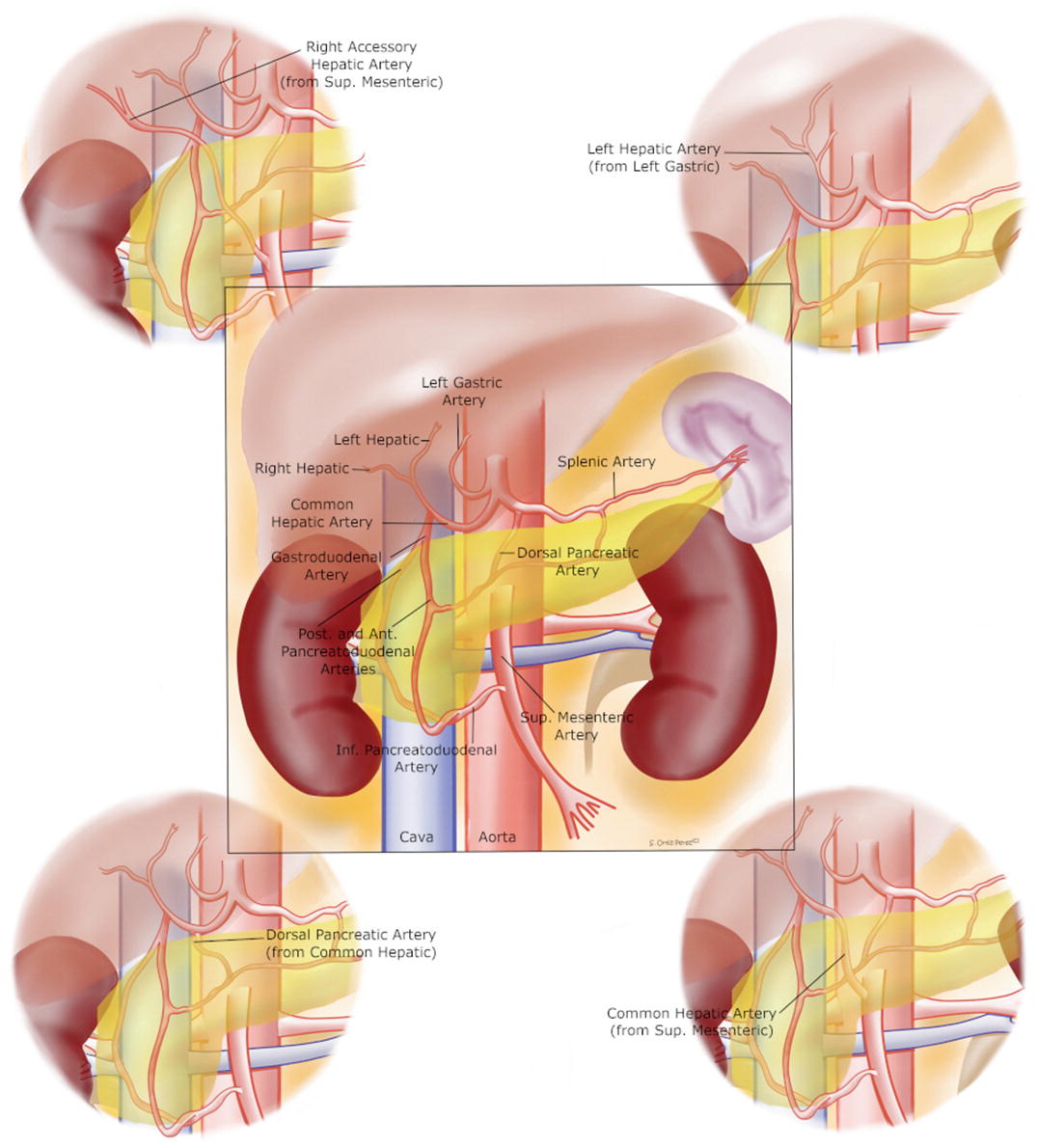 Procurement Of Abdominal Organs For Transplantation Multiorgan