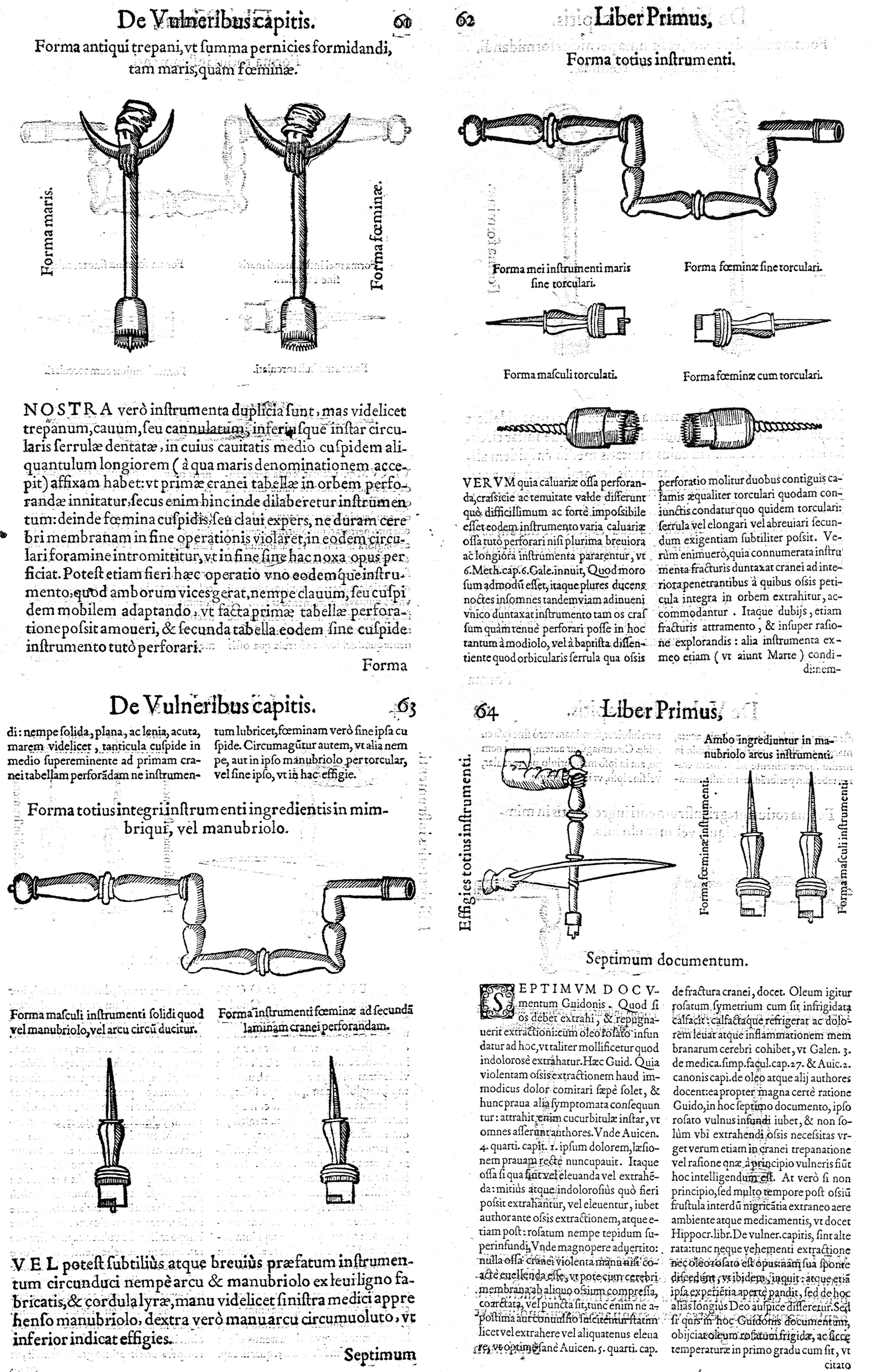 Cranial Trepanation During The Middle Ages Springerlink