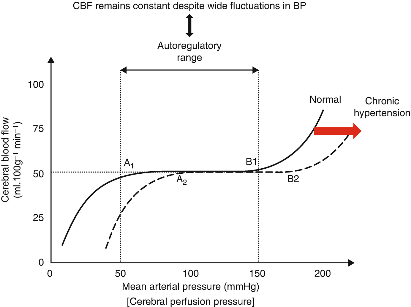 Brain Microcirculation And Silent Cerebral Damage Springerlink