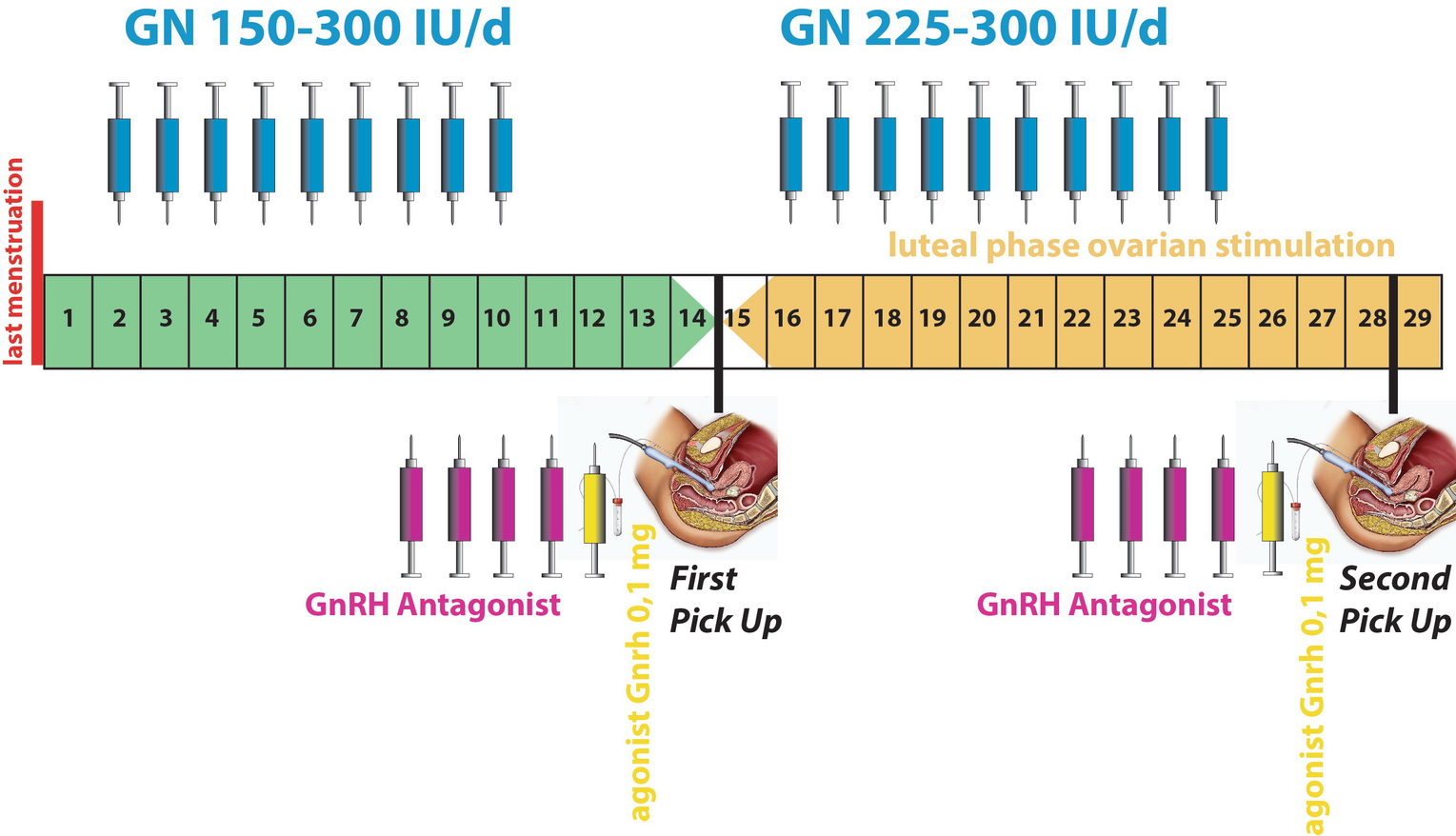 Oocyte Retrieval In Double Stimulation Springerlink