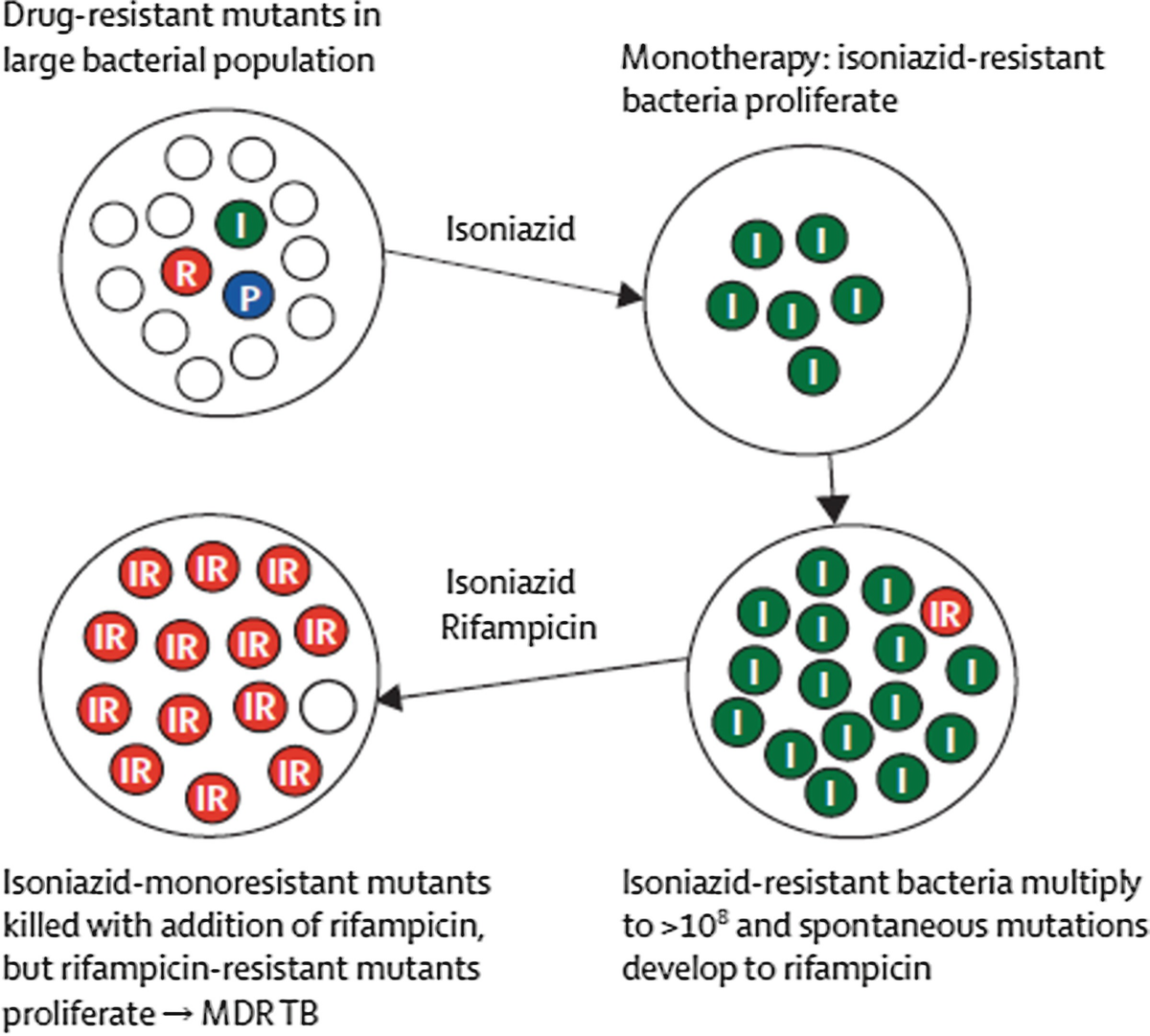 Drug Resistant Tuberculosis And Hiv Springerlink