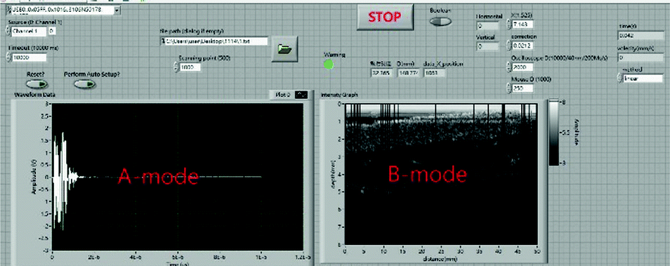 A Free Hand System Of The High Frequency Single Element Ultrasound