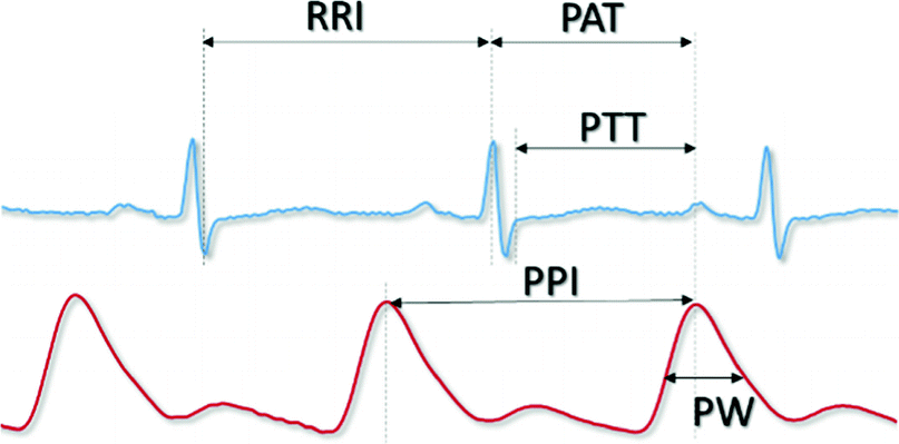 Blood Pressure Variation Trend Analysis Based On Model Study Springerlink
