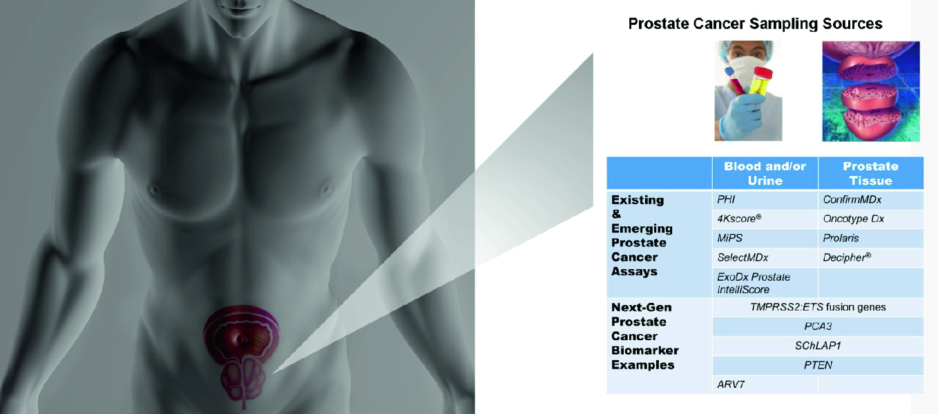 18 éves prostatitis, A krónikus prosztatagyulladás tünetei és kezelése