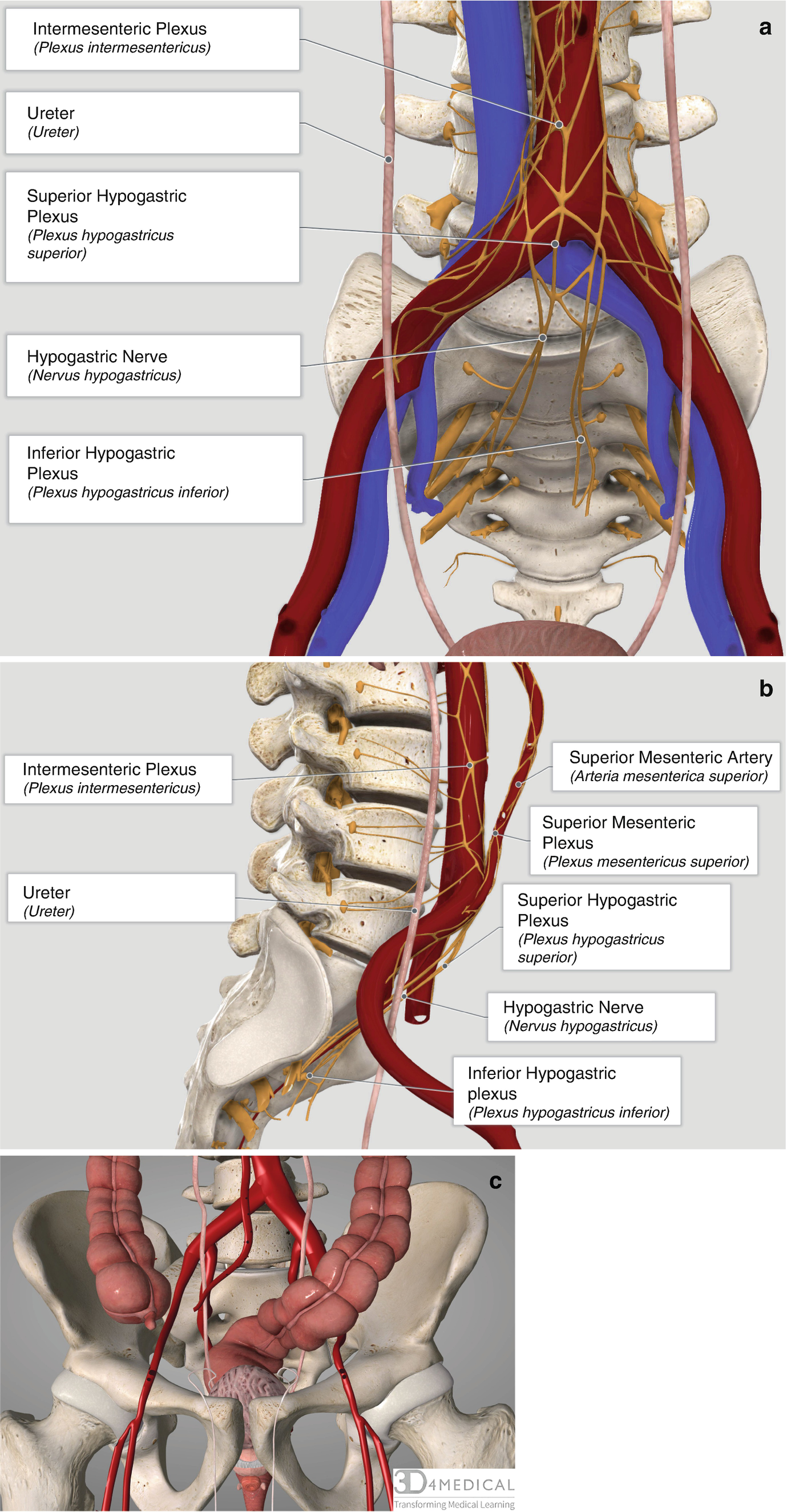 Superior Hypogastric Plexus Block Anterior Approach Springerlink Superior Hypogastric Plexus Block Anterior Approach Springerlink