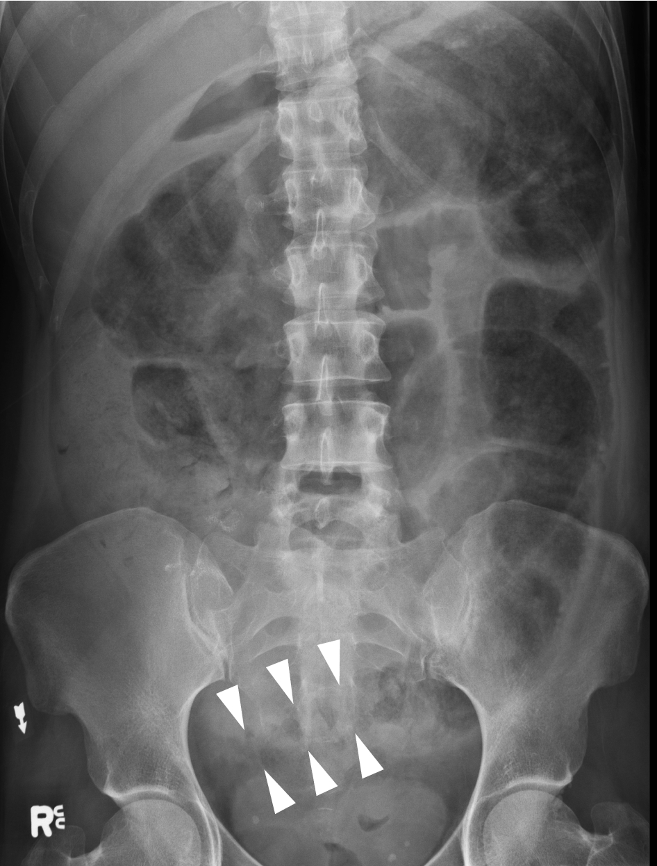 Tutorial 10 The Abdominal Radiograph Springerlink