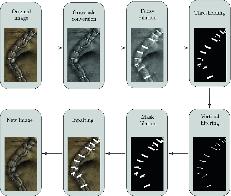 Detection And Automatic Deletion Of Staples In Images Of Wound Of Abdominal Surgery For M Health Applications Springerlink Detection And Automatic Deletion Of Staples In Images Of Wound Of Abdominal Surgery For M Health Applications Springerlink
