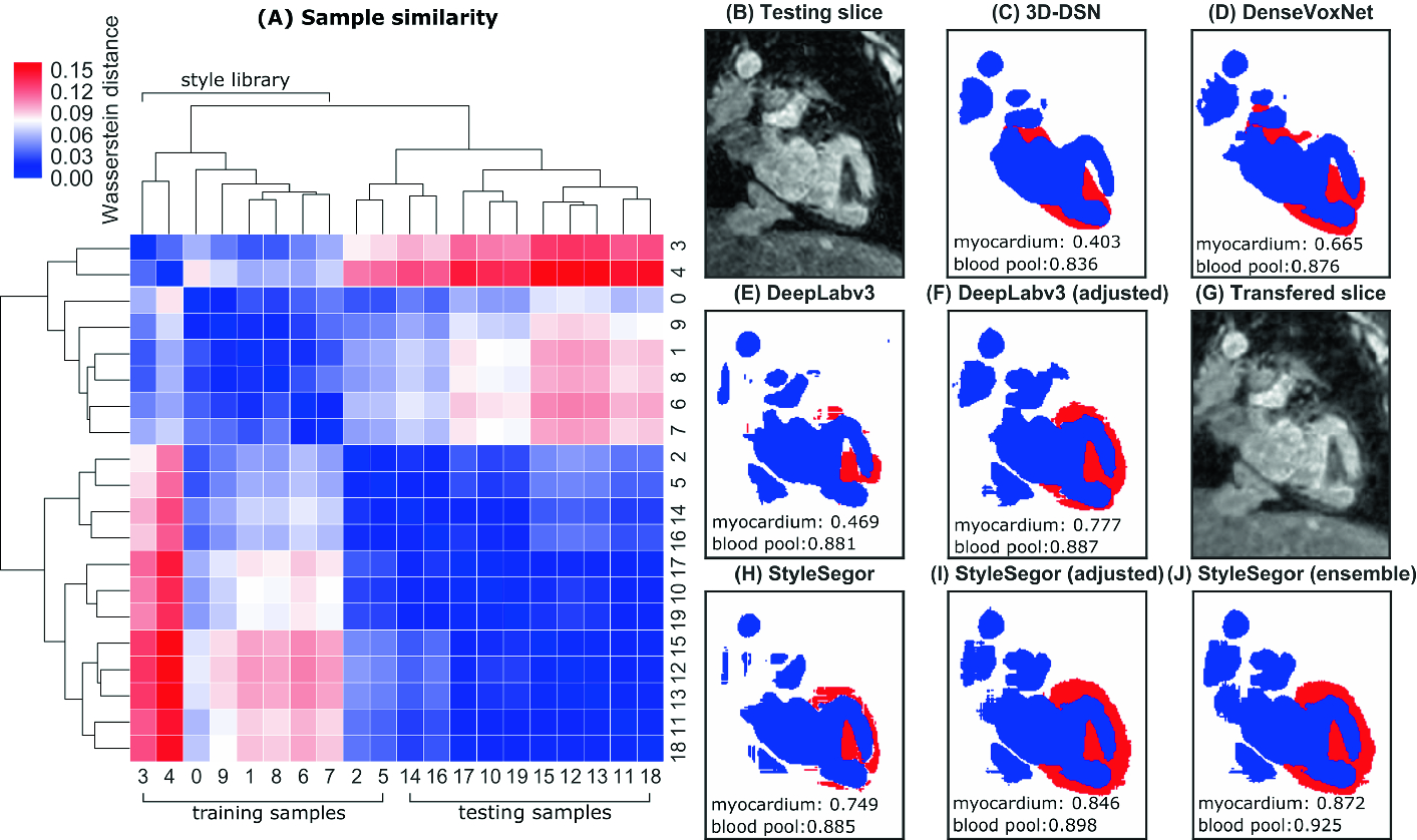 Neural Style Transfer Improves 3d Cardiovascular Mr Image Segmentation On Inconsistent Data Springerlink