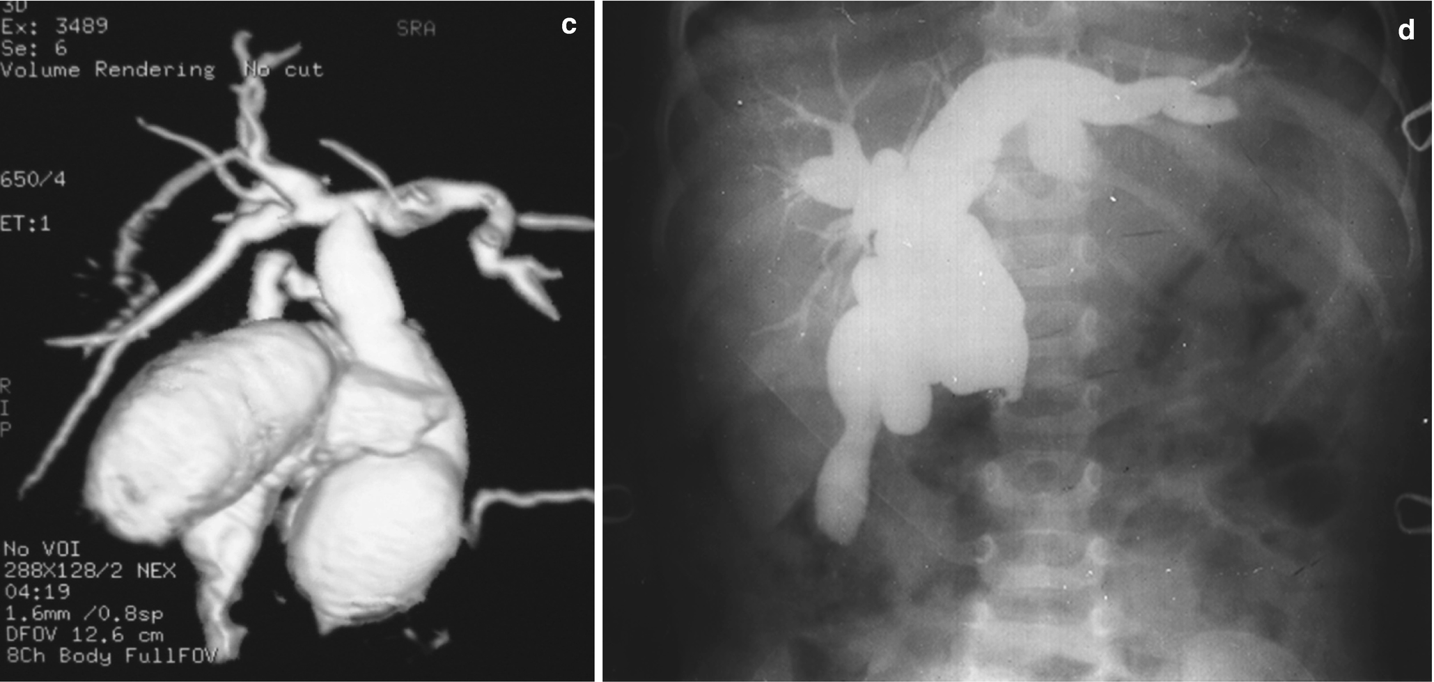 Abdomen Springerlink