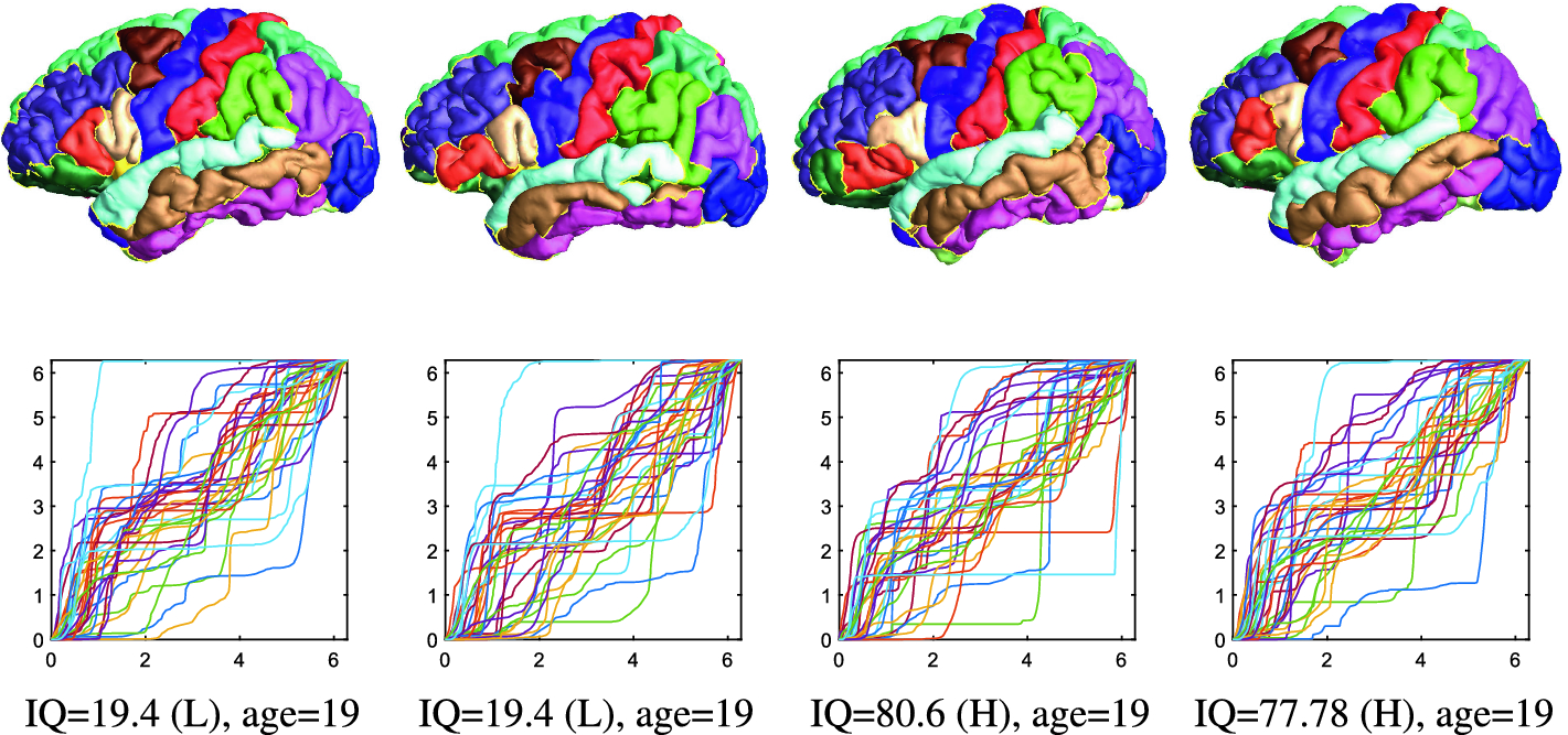 Conformal Welding For Brain Intelligence Analysis Springerlink