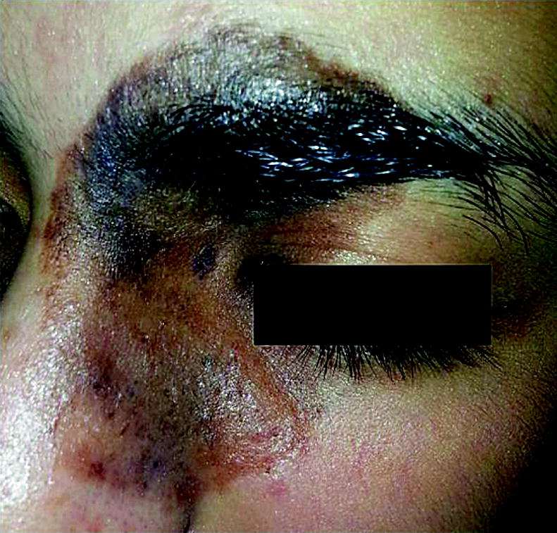 rc skin growth factor eye contour cream