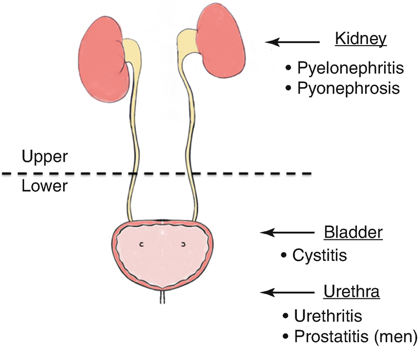 hogyan lehet megbetegedni a prostatitisben