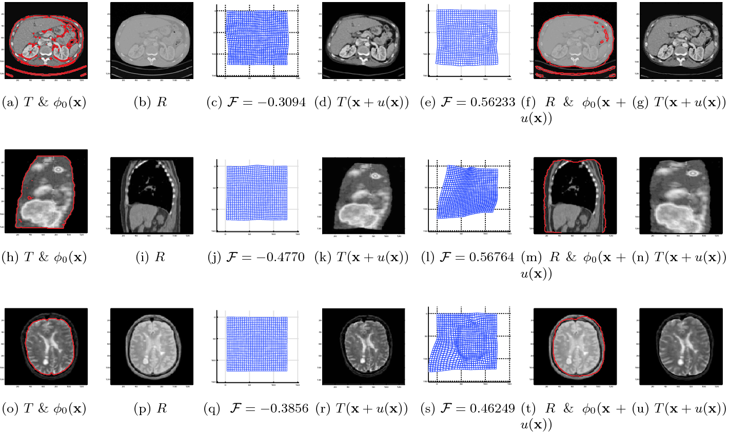 A Variational Joint Segmentation And Registration Framework For Multimodal Images Springerlink