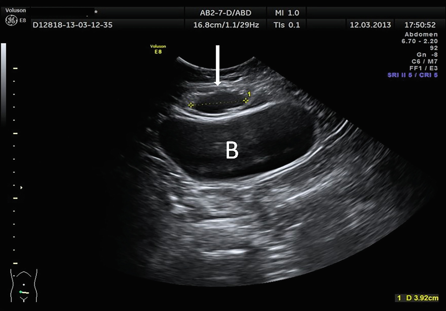Ultrasonographic Techniques And Clinical Applications Springerlink