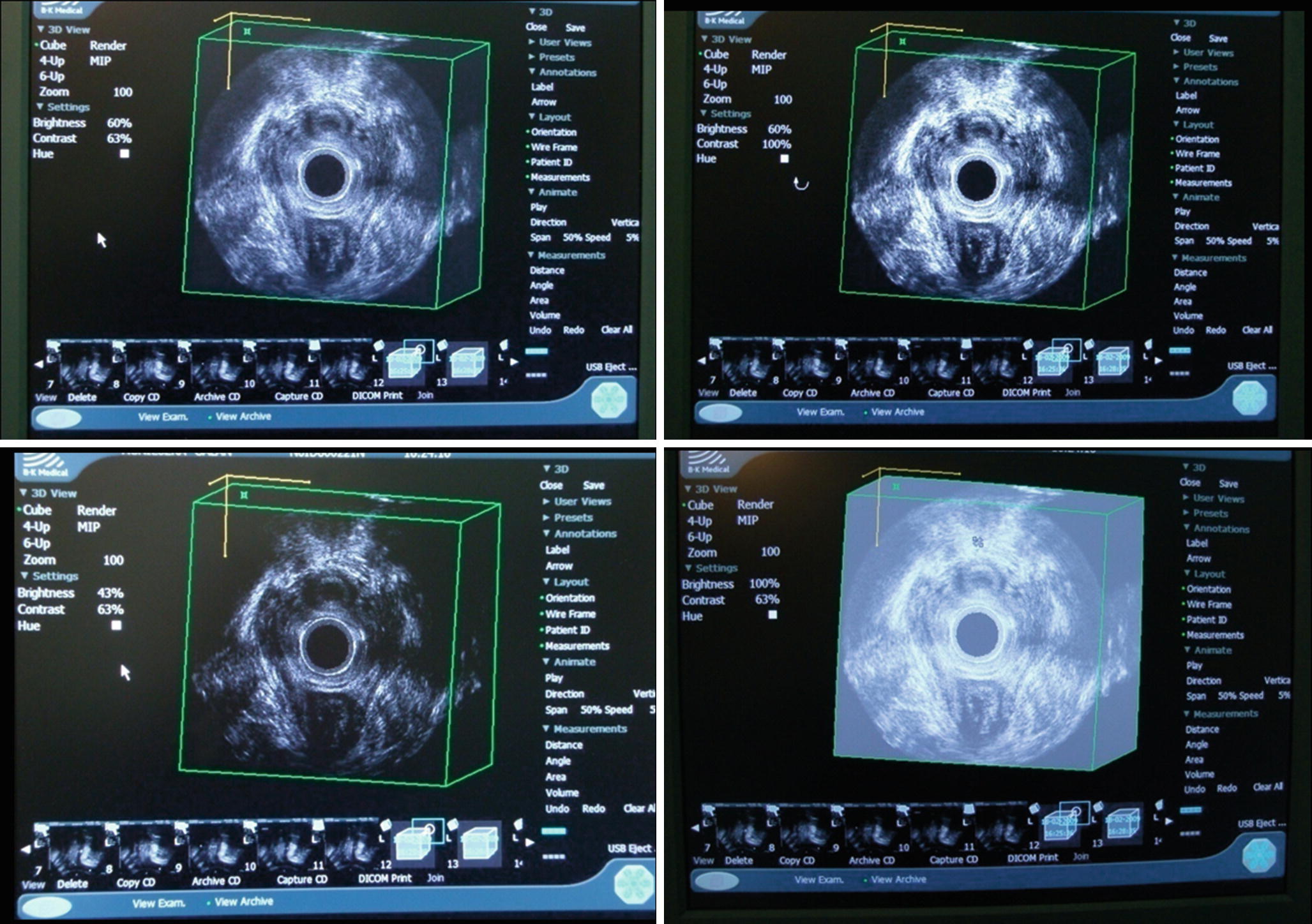 Principles And Technical Aspects Of Integrated Pelvic Floor Ultrasound Springerlink