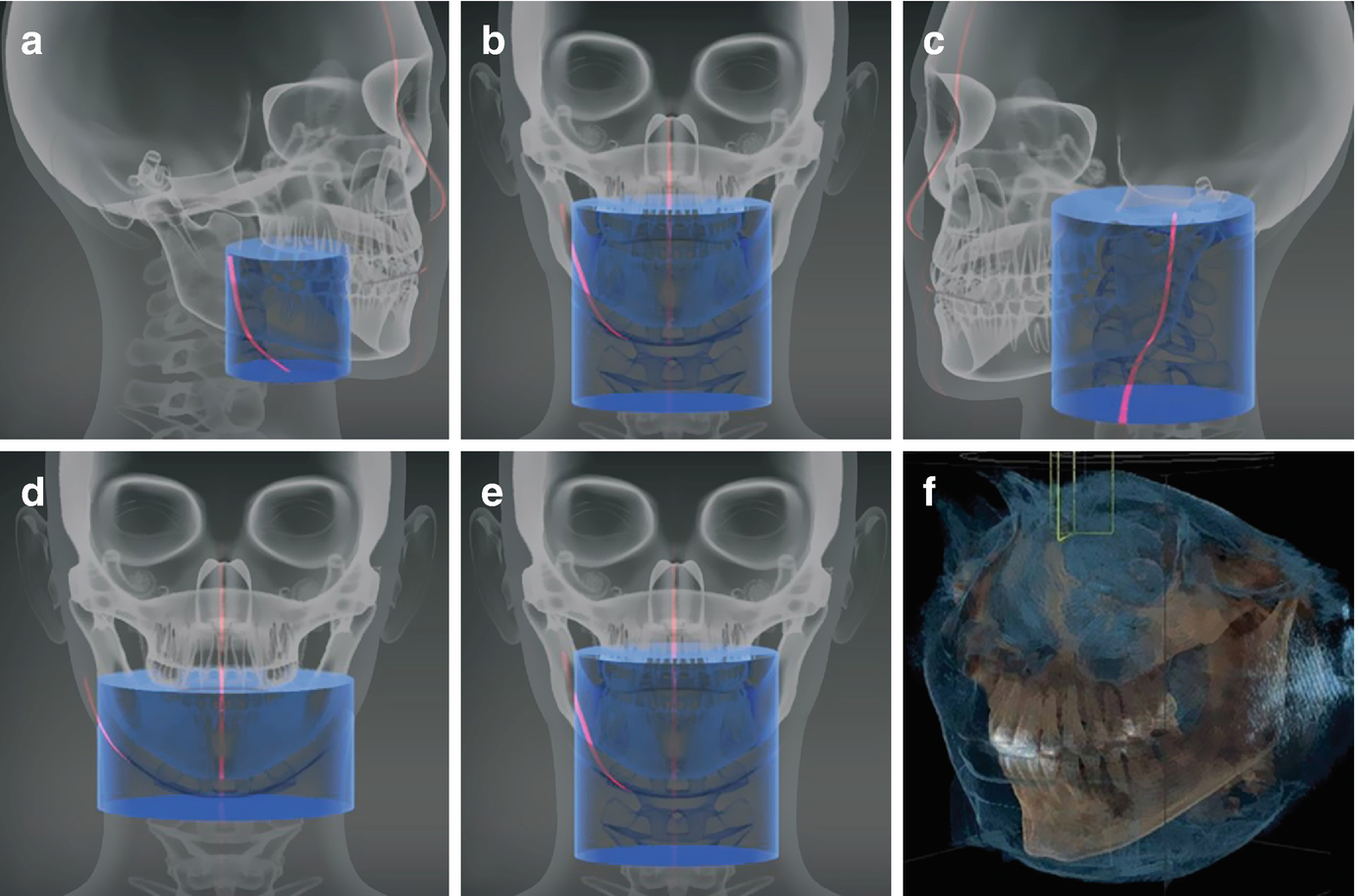 kodak dental imaging software 6.12 download