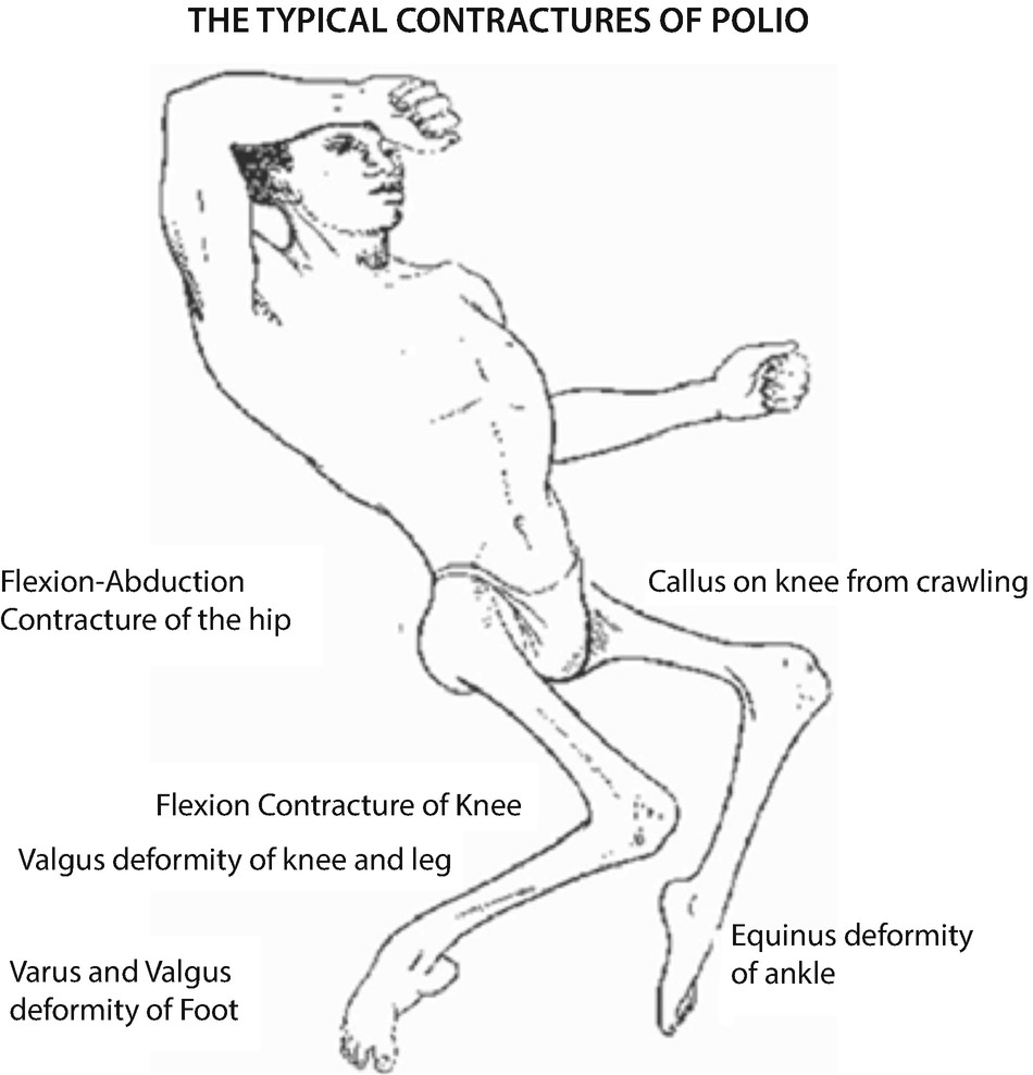 Featured image of post Kneeling Crying Pose Reference