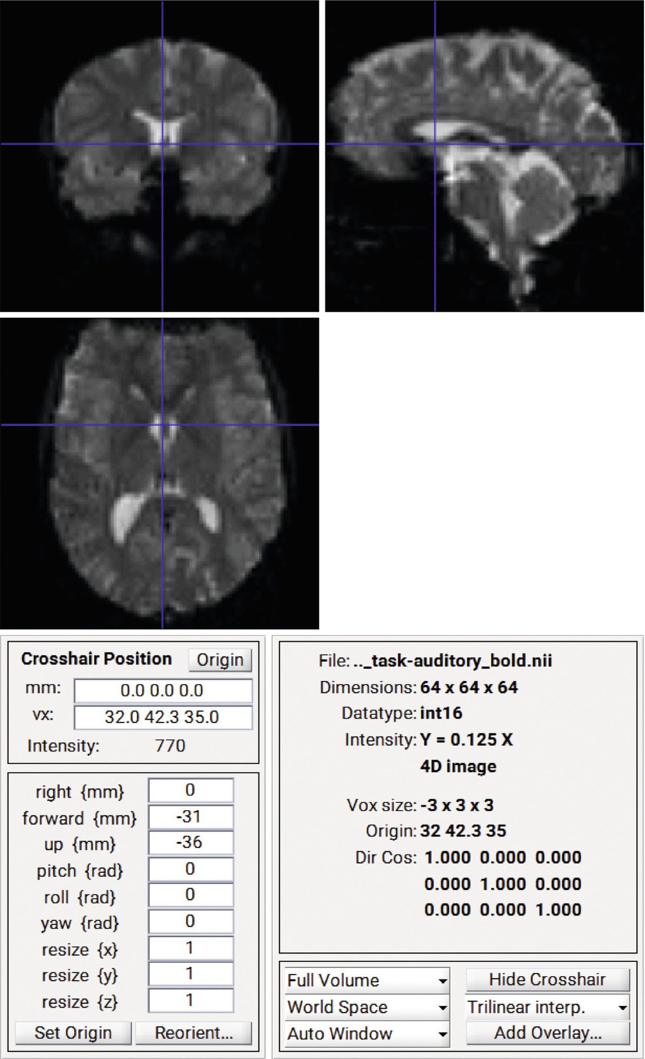 Fmri Data Analysis Using Spm Springerlink Fmri Data Analysis Using Spm Springerlink