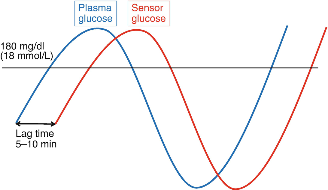 Different Types Of Continuous Glucose Monitoring Systems On The Market Springerlink